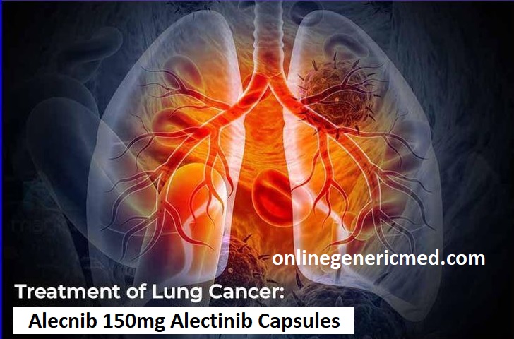 Alecnib 150mg Alectinib