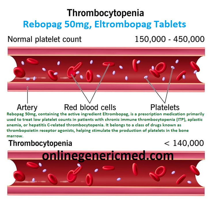 Rebopag 50mg, (Eltrombopag)