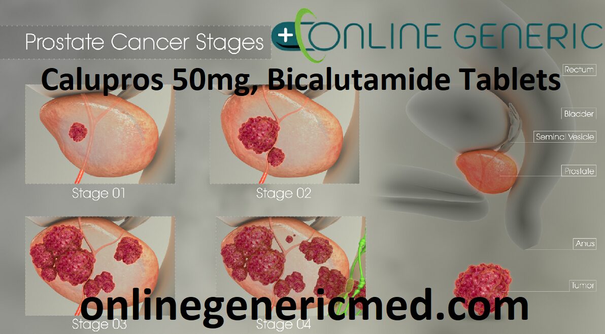 Calupros 50mg, Bicalutamide Tablets