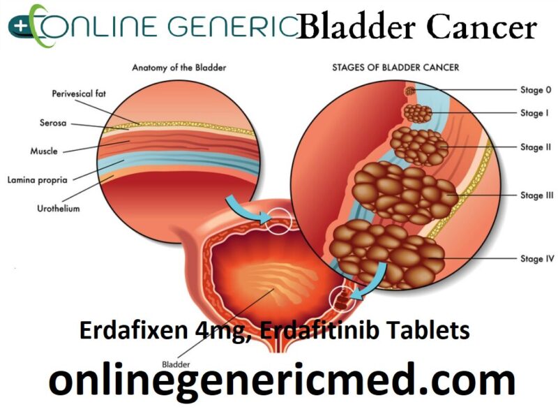 Erdafixen 4mg, Erdafitinib Tablets
