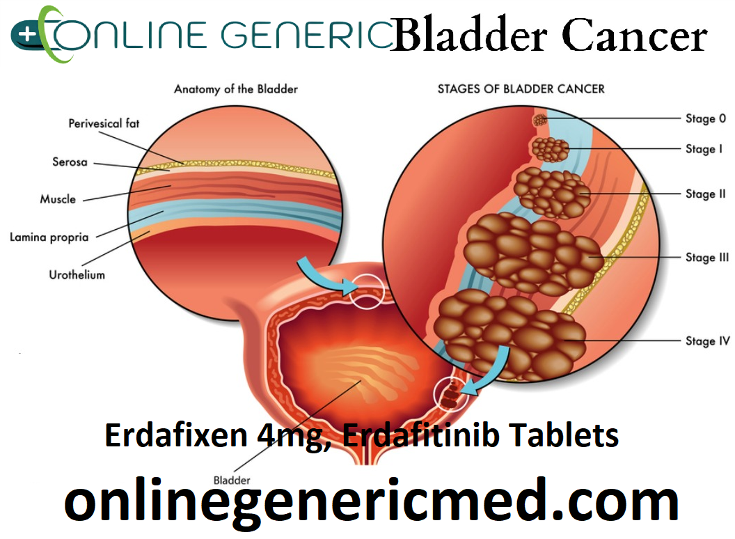Erdafixen 4mg, Erdafitinib Tablets