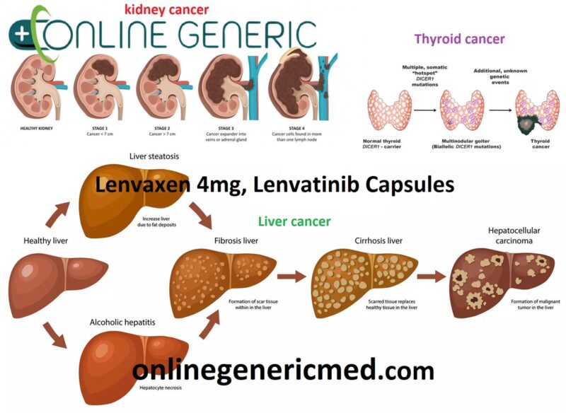 Lenvaxen 4mg, Lenvatinib Capsules