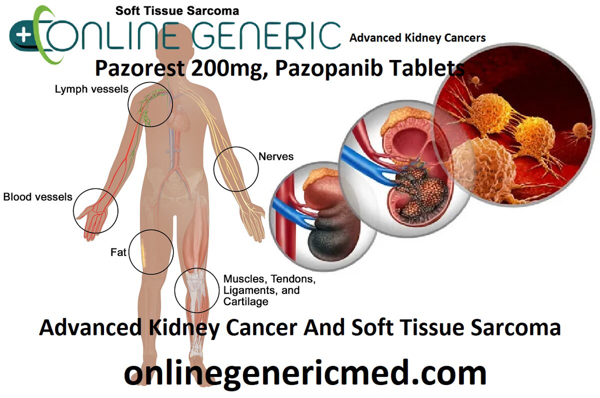 Pazorest 200mg: Transforming Cancer Care with Targeted Therapy